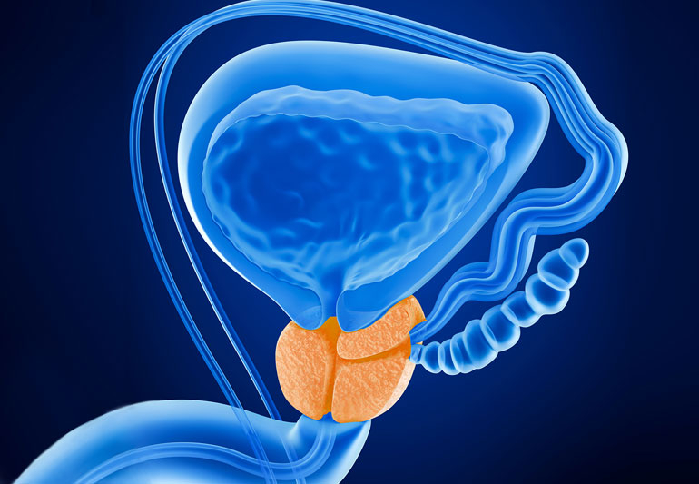 2025. október 14.- A FÉRFIRÁK MEGELŐZÉSE ÉS GYÓGYÍTÁSA 2 prostate 588242562 770x533 1 2